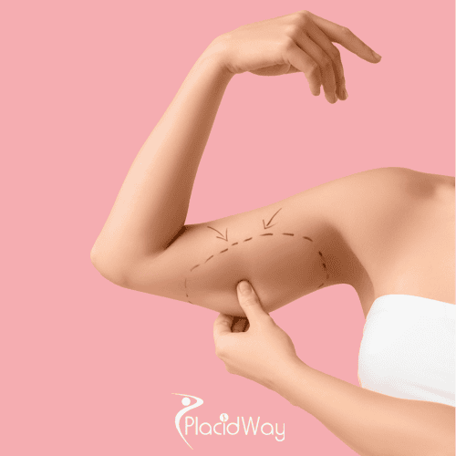 High-Tech Body Contouring: Why Guadalajara is Leading the VASER Liposuction Boom in 2026